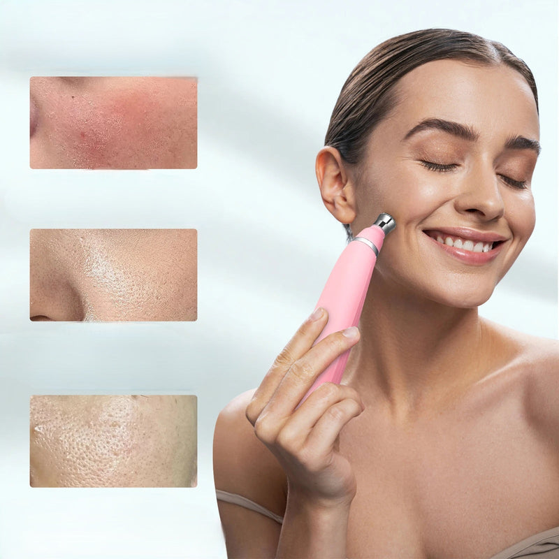 Diamond Microdermabrasion Facial Device - Portable Exfoliation Vacuum for Deep Cleaning, Blackhead Removal, and Glowing Skin Care
