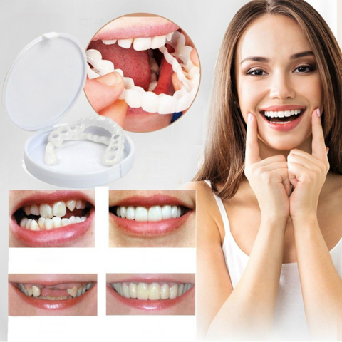 Snap on Smile Veneers - Top rated Teeth Veneers