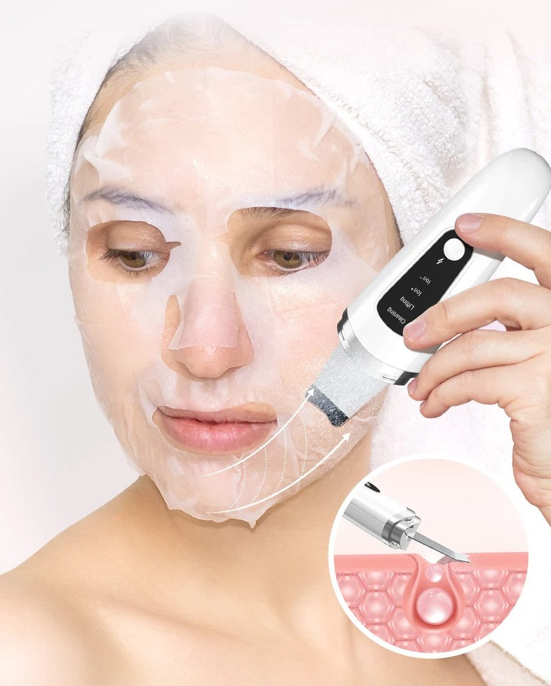 Ultrasonic Skin Scrubber Face Spatula – Deep Pore Exfoliation and Blackhead Removal for Smoother, Clearer, Healthier-Looking Skin