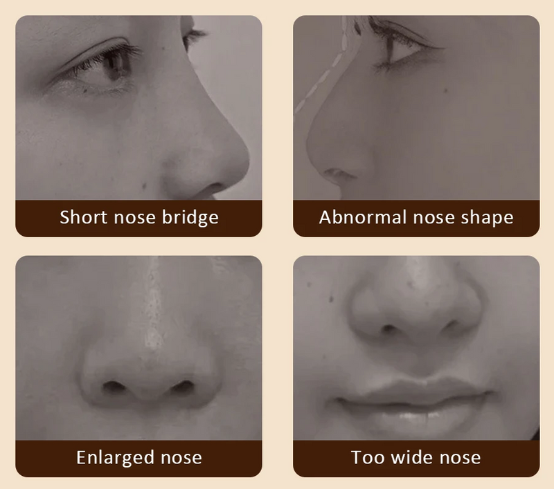 Ultrasonic Nose Lifting Massage Device – Reduces Nasal Swelling, Clears Sinuses, and Lifts Facial Contours with Hot Compress Therapy