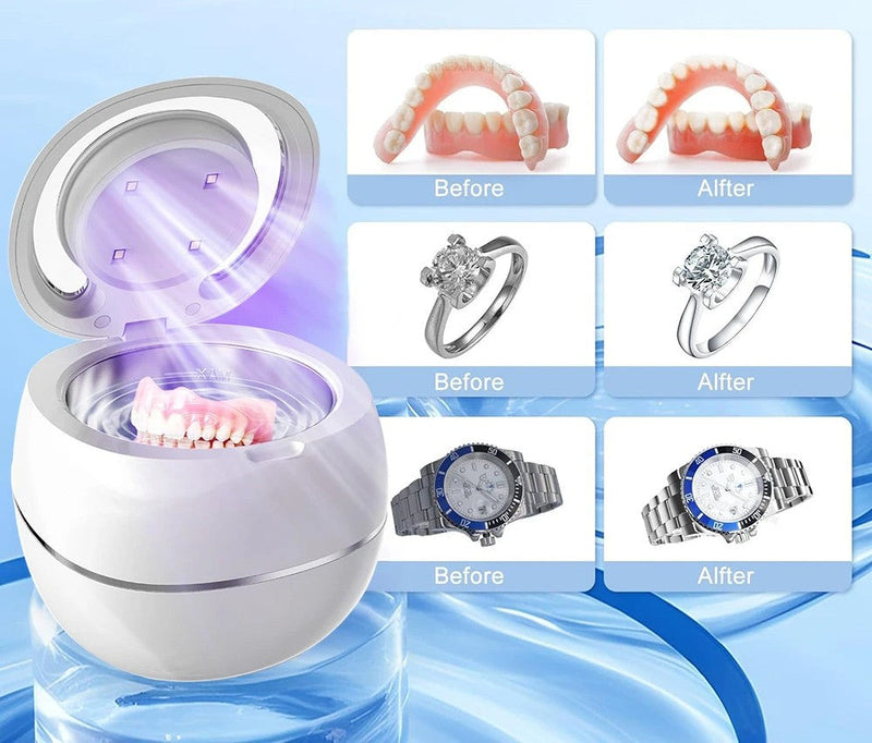 Mini UV Ultrasonic Cleaner – Portable Cleaning Machine for Sparkling Retainers, Dentures, and Jewelry