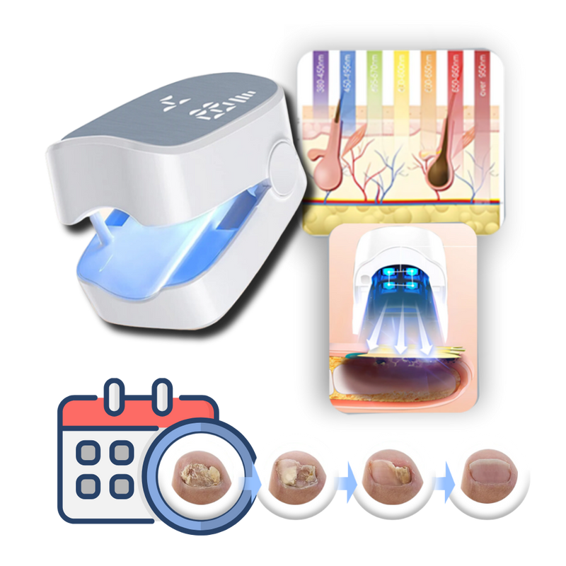 Painless laser treatment for nail fungus