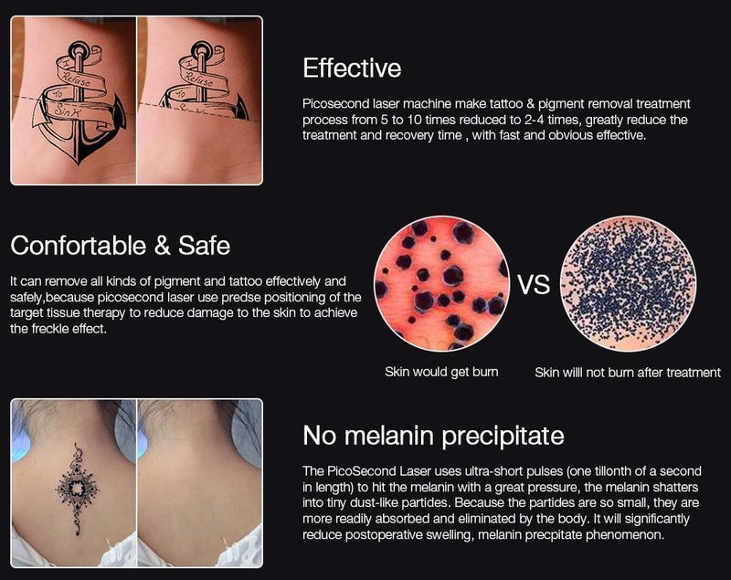 Professional Laser Pen Tattoo Removal, Mole, Freckles, Acne removal