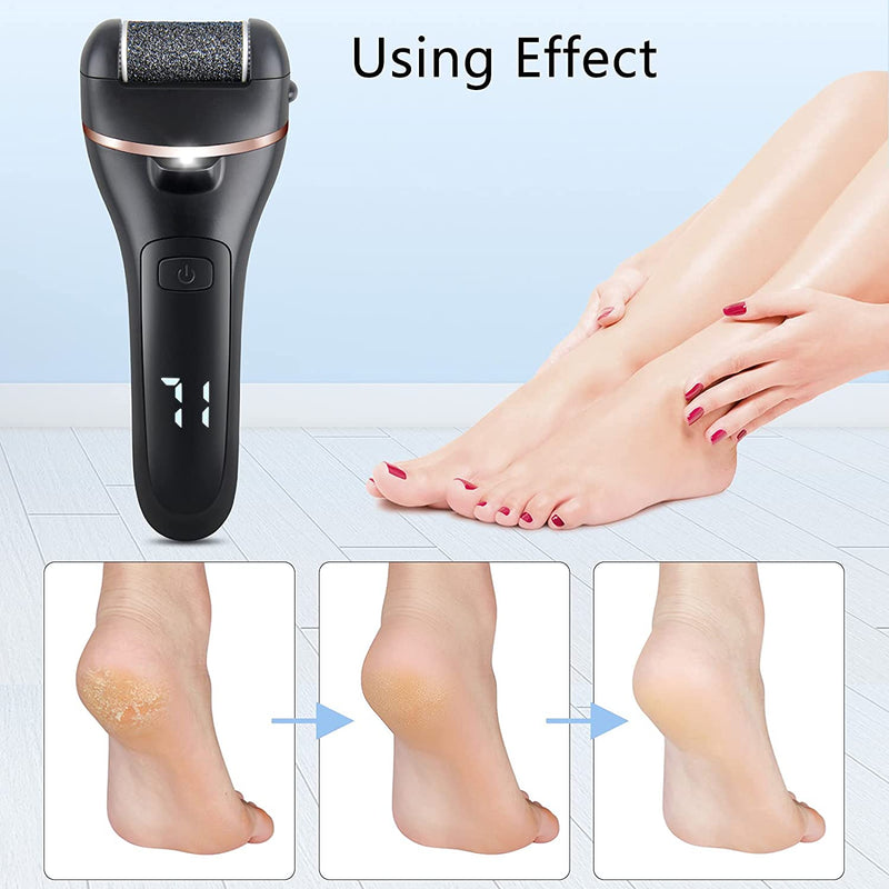 Electric Foot File & Pedicure Kit | Rechargable